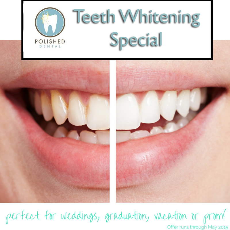 Just in time for spring weddings, graduations, vacations and prom, Polished Dental is offering teeth whitening specials in April and May